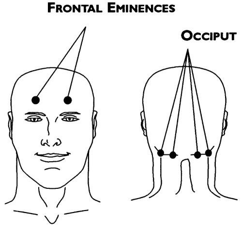 Frontal_eminences